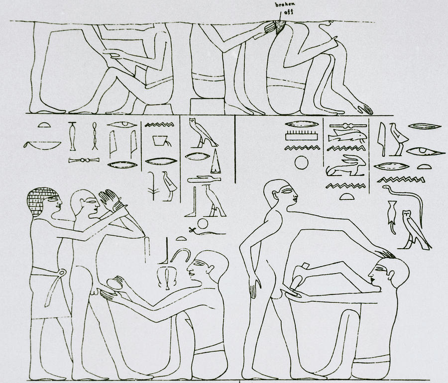 Ancient Circumcision Photograph by Science Photo Library Ancient Circumcision Photograph by Science Photo Library