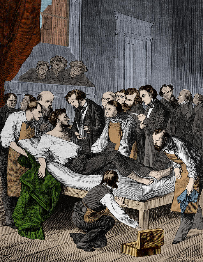 Anesthesia, 1846 Photograph by Science Source