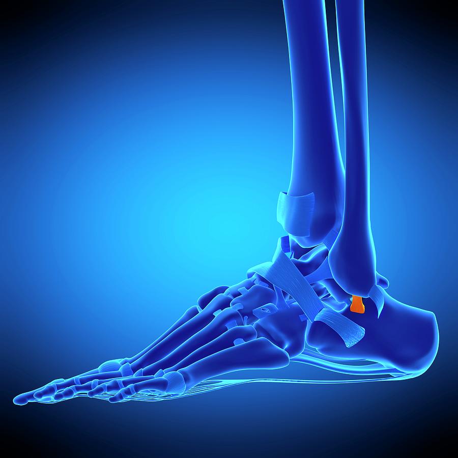 Ankle Ligament Photograph by Sebastian Kaulitzki/science Photo Library ...