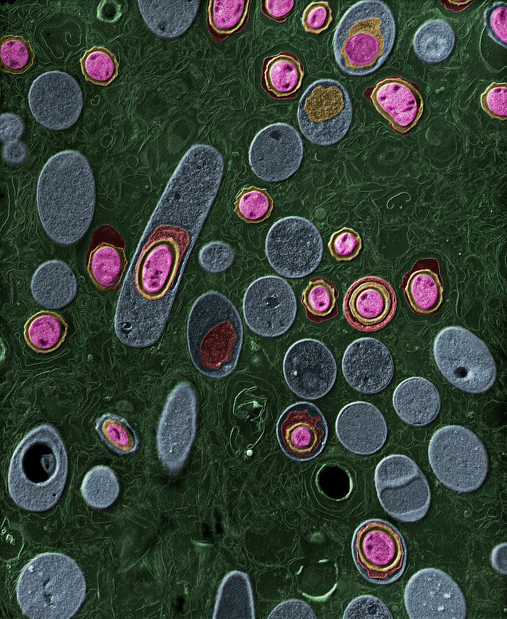 Anthrax Bacteria Bacillus Anthracis Photograph By Eye Of Science Pixels 4447