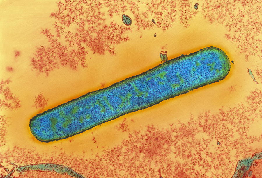 Anthrax Bacterium Photograph by A. Dowsett, Health Protection Agency/science Photo Library