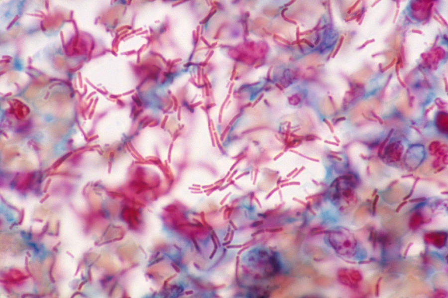 Anthrax-infected Tissue, Lm Photograph by Michael Abbey