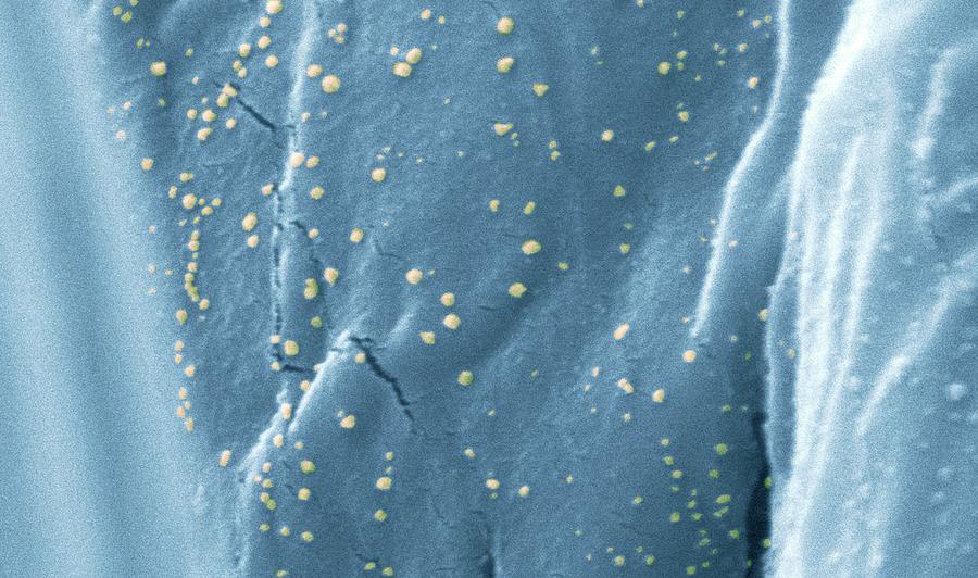 Anti-microbial Silver On Cotton Photograph by Science Photo Library Anti-microbial Silver On Cotton Photograph by Science Photo Library