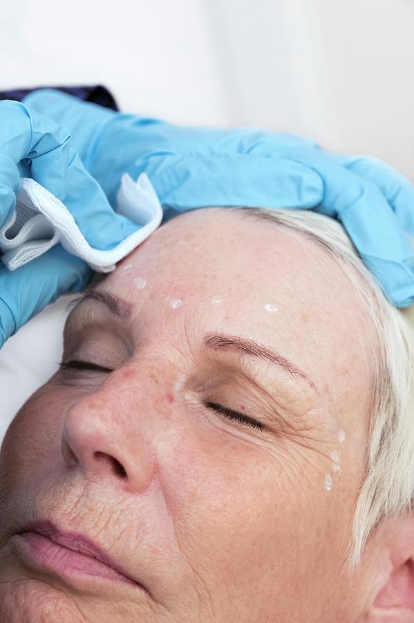 Anti wrinkle Treatment by Lewis Houghton science Photo Library