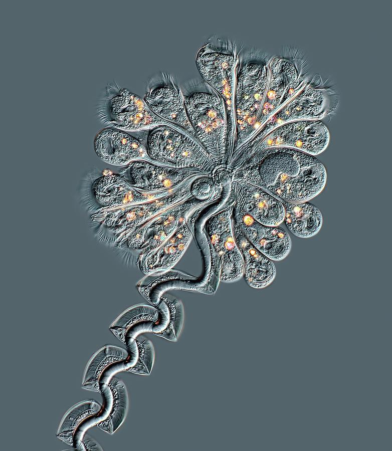 Apocarchesium Protozoa Colony Photograph by Rogelio Moreno/science Photo Library