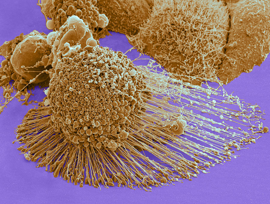 Apoptotic Hela Cell, Sem Photograph by Science Source