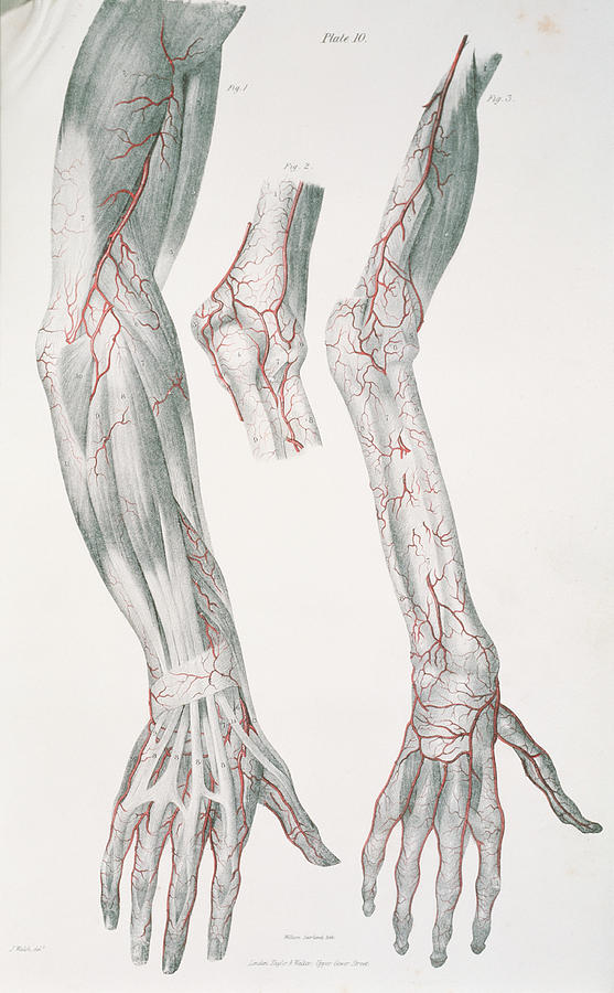 Arm Arteries Photograph by Sheila Terry/science Photo Library - Fine ...