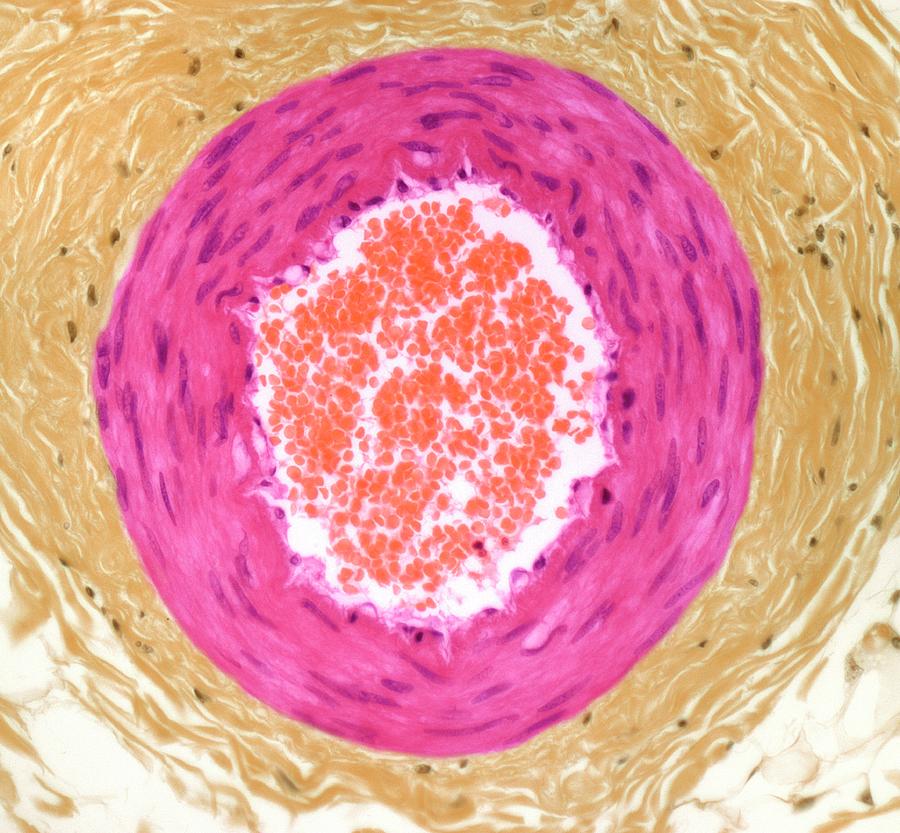 Arteriole Blood Vessel Photograph by Steve Gschmeissner Arteriole Blood Vessel Photograph by Steve Gschmeissner