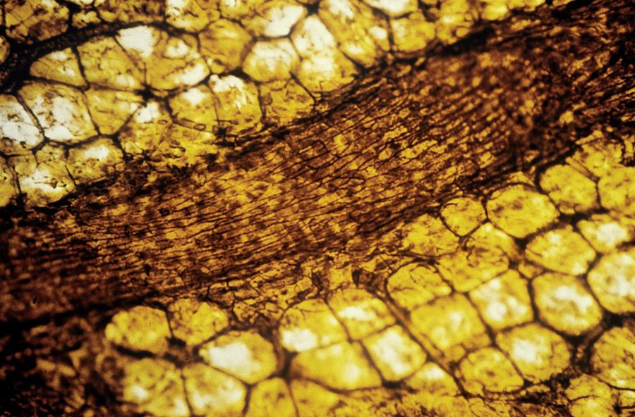 Artery And Fat Cells Photograph by Pr. E. Tamboise - Cnri