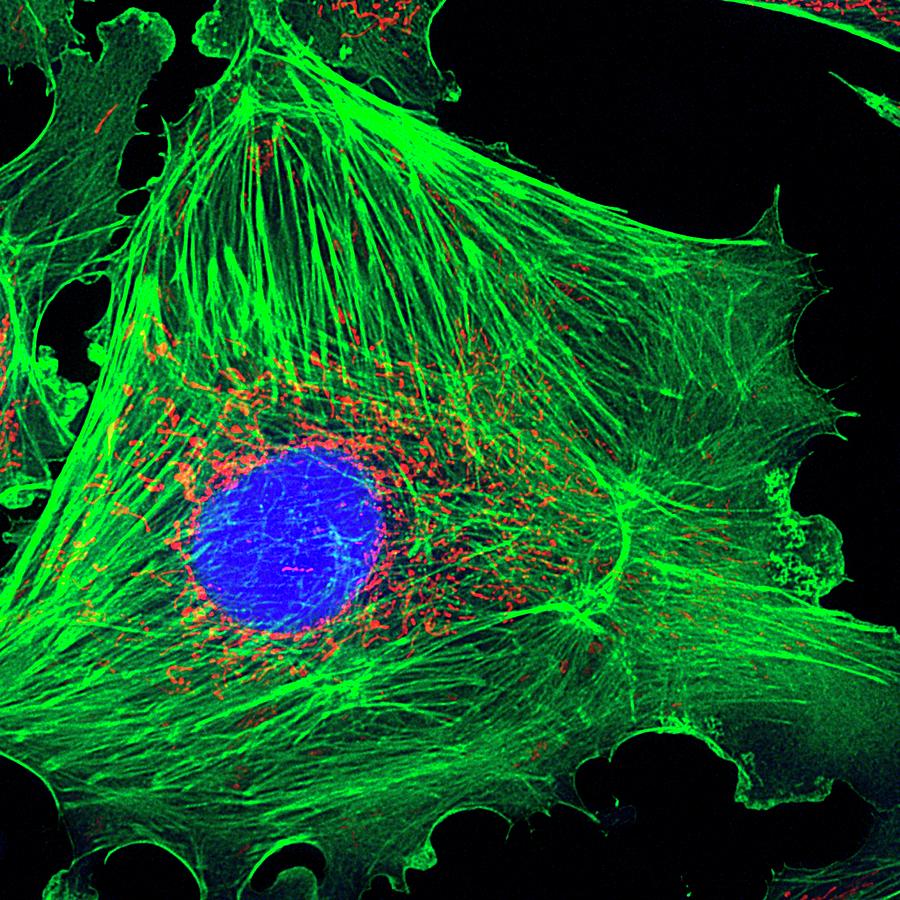 Artery Cell Photograph by Kevin Mackenzie / University Of Aberdeen / Science Photo Library