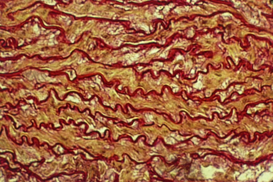 Artery Wall Tissue Photograph by Prof. R. Wegmann/science Photo Library