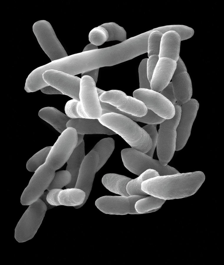 Arthrobacter Sp. Pleomorphic Photograph by Dennis Kunkel Microscopy/science Photo Library