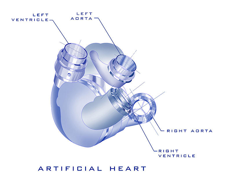 Artificial Heart Painting by James Hill