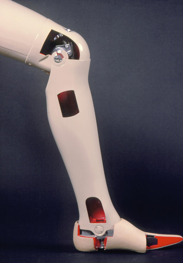 artificial-leg-photograph-by-james-stevenson-science-photo-library