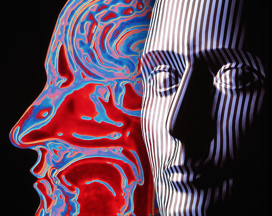 Artwork Of A Face And An Mri Scan Of A Head Photograph by Alfred