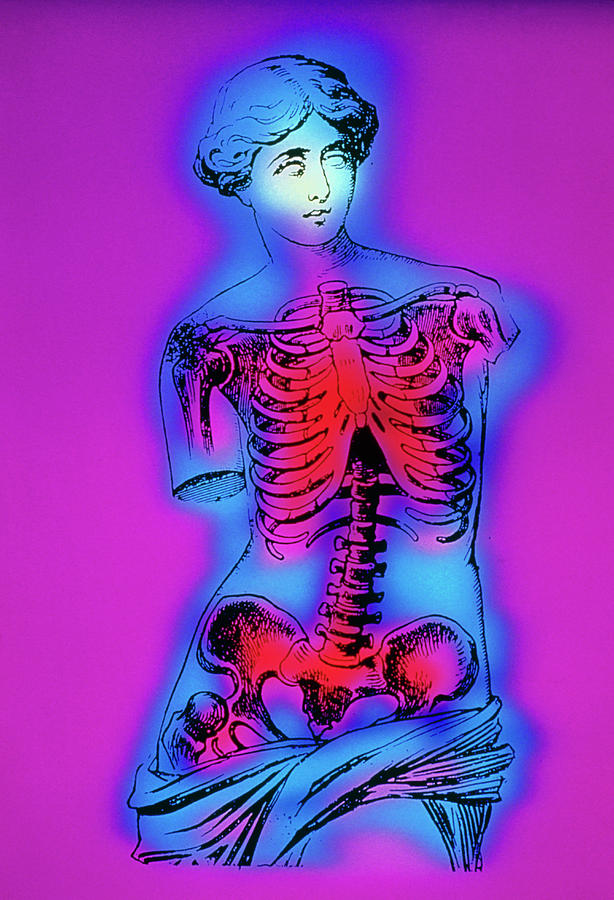 Artwork Of Human Skeleton On Venus De Milo Statue Photograph by Mehau Kulyk/science Photo Library