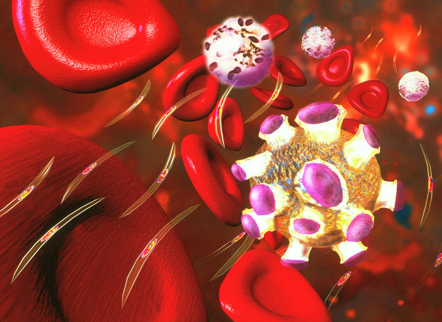 Images Photograph - Artwork Of Infected Red Blood Cells In Malaria by Alfred Pasieka/science Photo Library