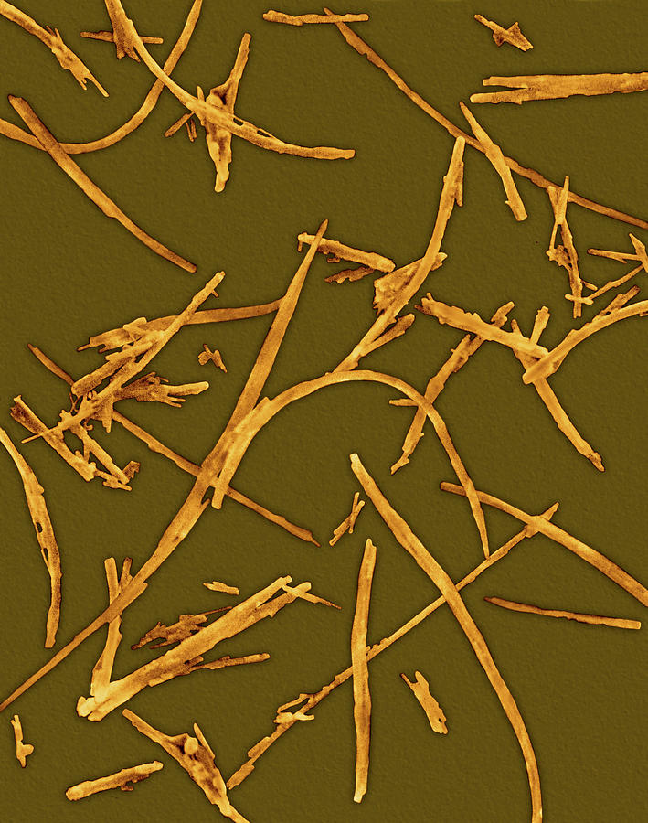 Asbestos Fiberschrysotile Type Photograph by Dennis Kunkel Microscopy/science Photo Library
