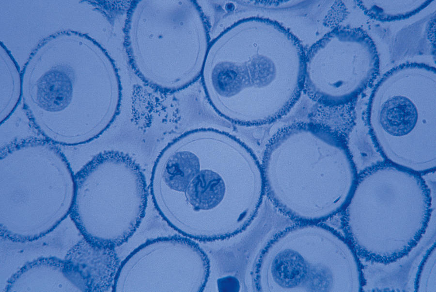Ascaris bivalent mitosis magnified 200x Photograph by Comstock