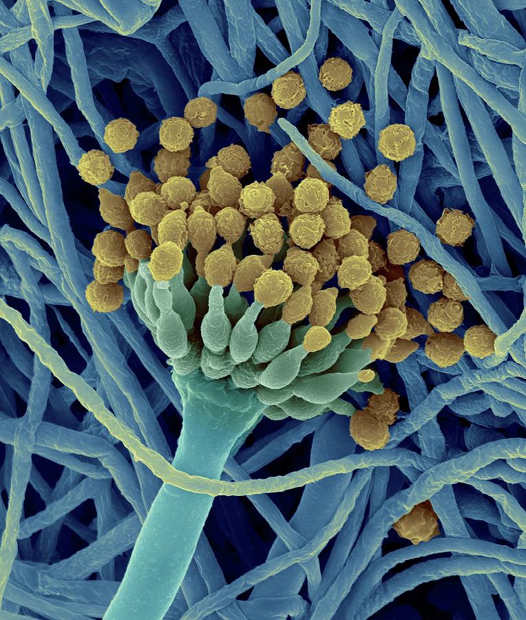 Aspergillus Ustus Hyphae And Structure Photograph by Dennis Kunkel Microscopy/science Photo Library