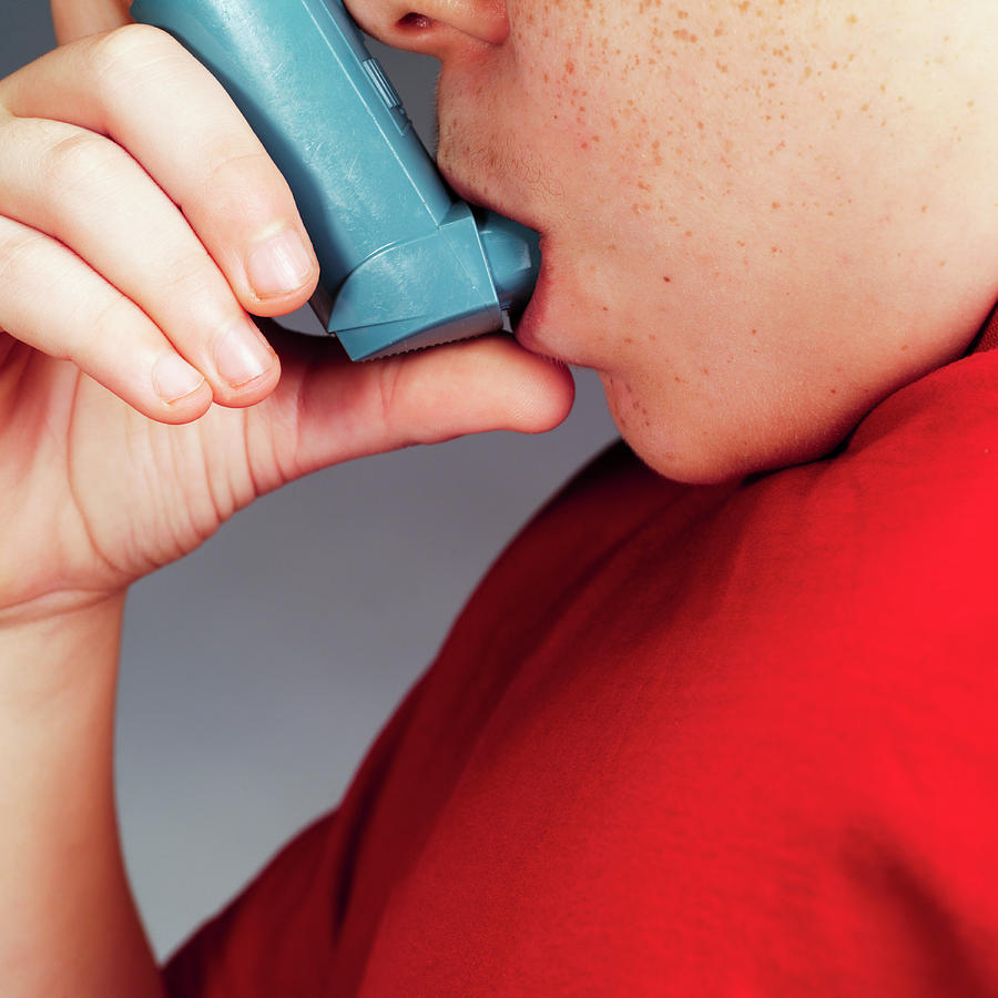 Asthma Photograph - Asthmatic Boy by Coneyl Jay/science Photo Library