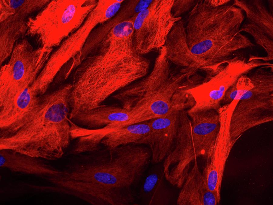 Astrocyte Glial Cells Photograph by Daniel Schroen, Cell Applications Inc
