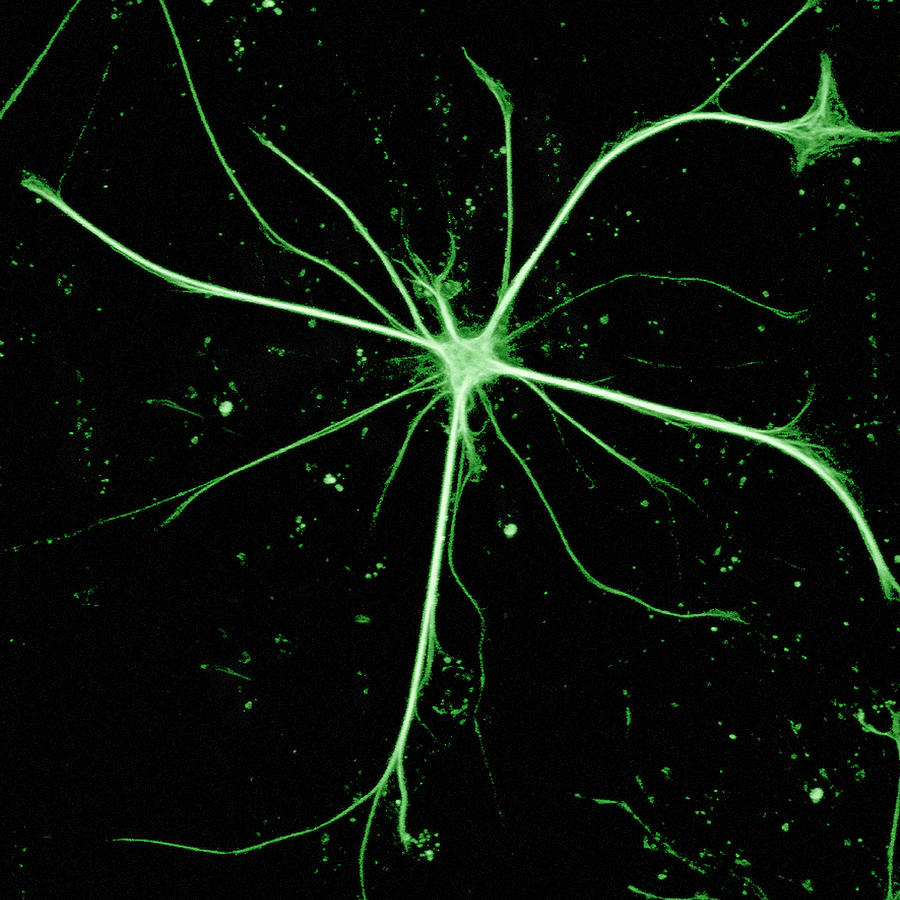 Astrocyte Nerve Cell Photograph by C.j.guerin, Phd, Mrc Toxicology Unit/ Science Photo Library