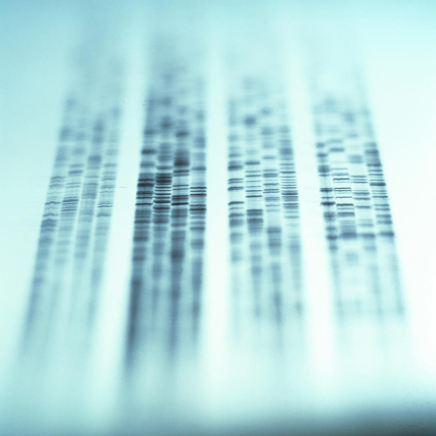 Dna Sequence Photograph - Autoradiogram Showing A Dna Fingerprint by Colin Cuthbert/science Photo Library
