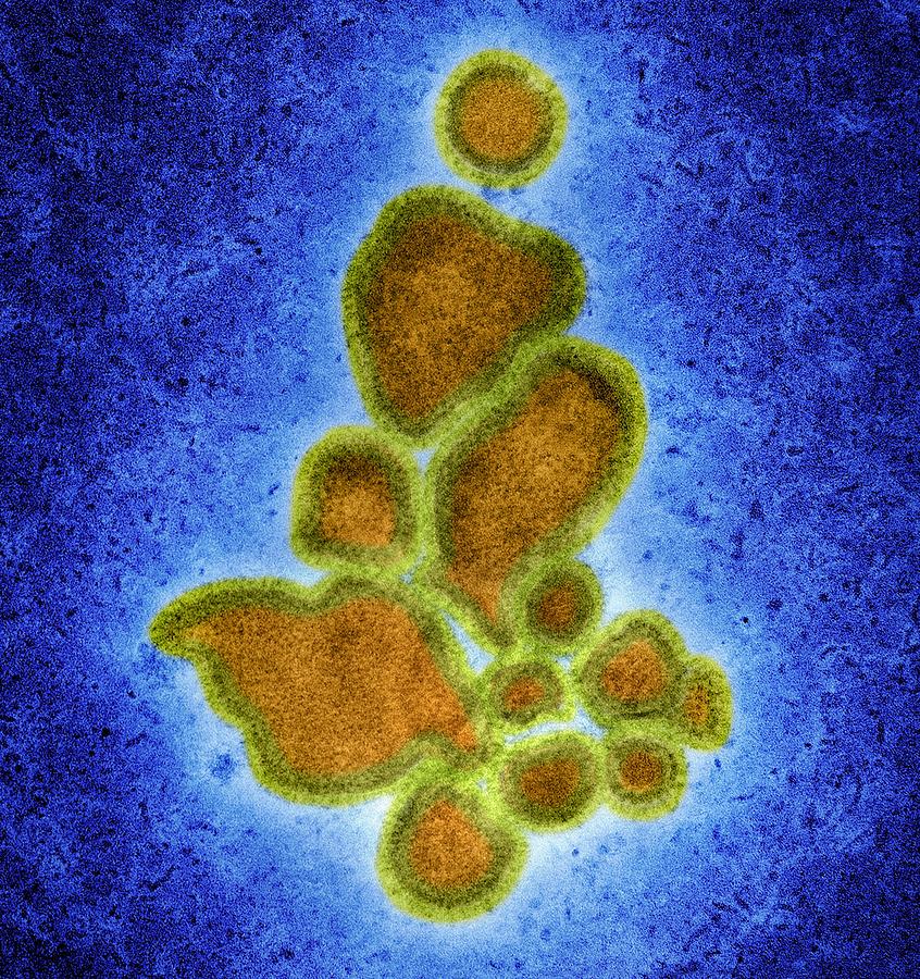 Avian influenza virus, TEM Photograph by Science Photo Library