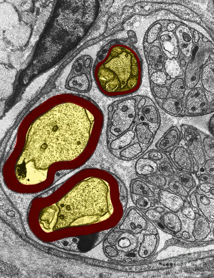 Axons In Rat Cell, Tem Photograph by David M. Phillips