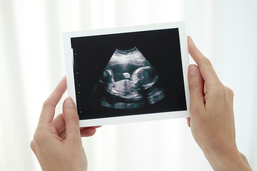 Baby Scan Photograph By Science Photo Library - Fine Art America