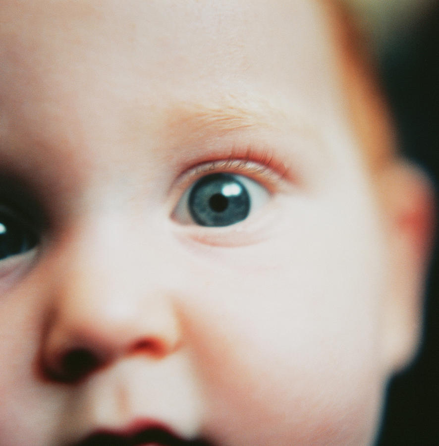 Babys Face Photograph by Cristina Pedrazzini/science Photo Library