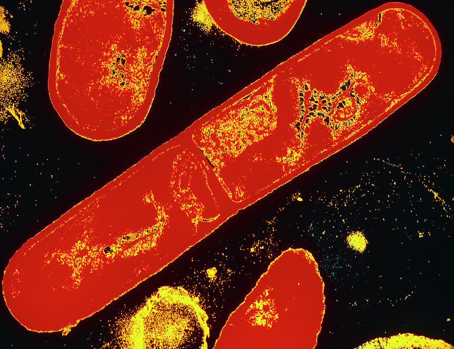 Bacillus Subtilis Bacterium Photograph by Dr Tony Brain/science Photo Library