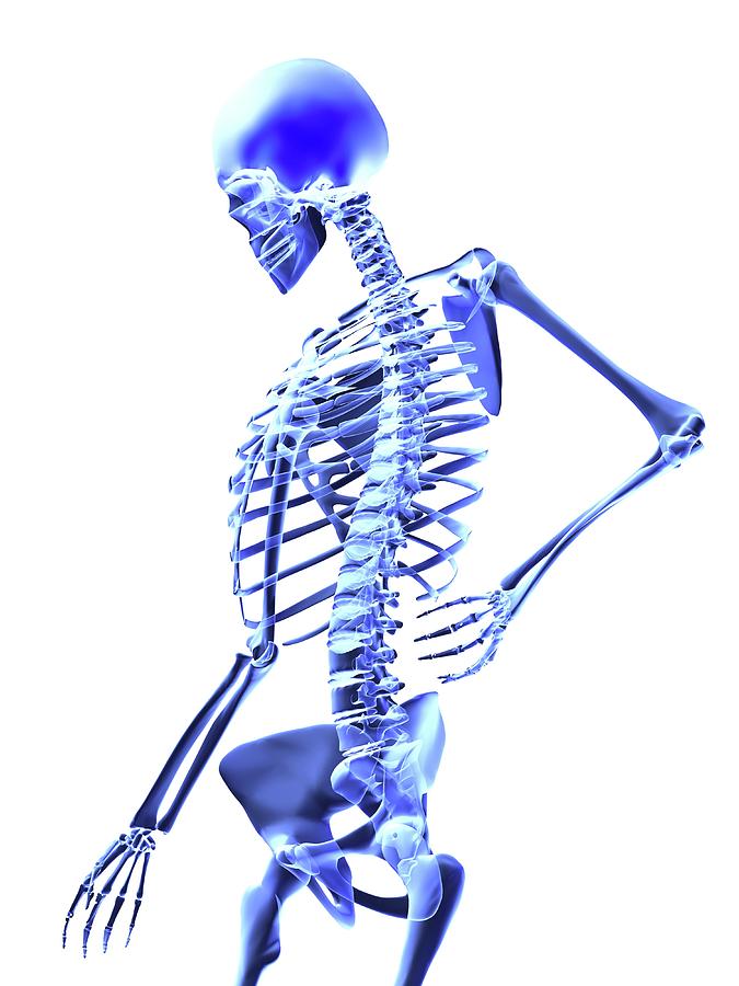 Skeleton Photograph - Back Pain by Alfred Pasieka