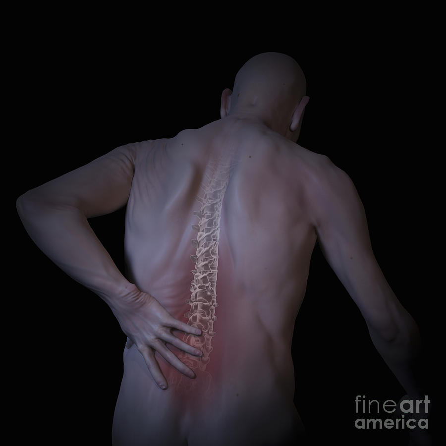 Back Pain Photograph by Science Picture Co