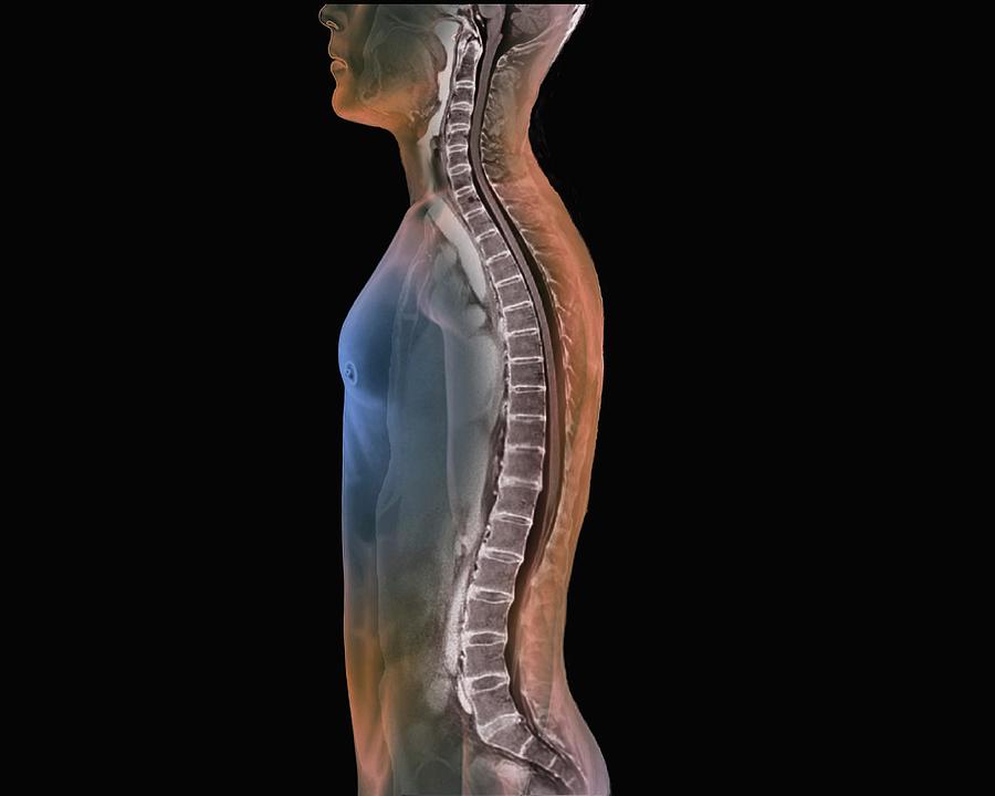 backbone-and-spinal-cord-photograph-by-zephyr-science-photo-library