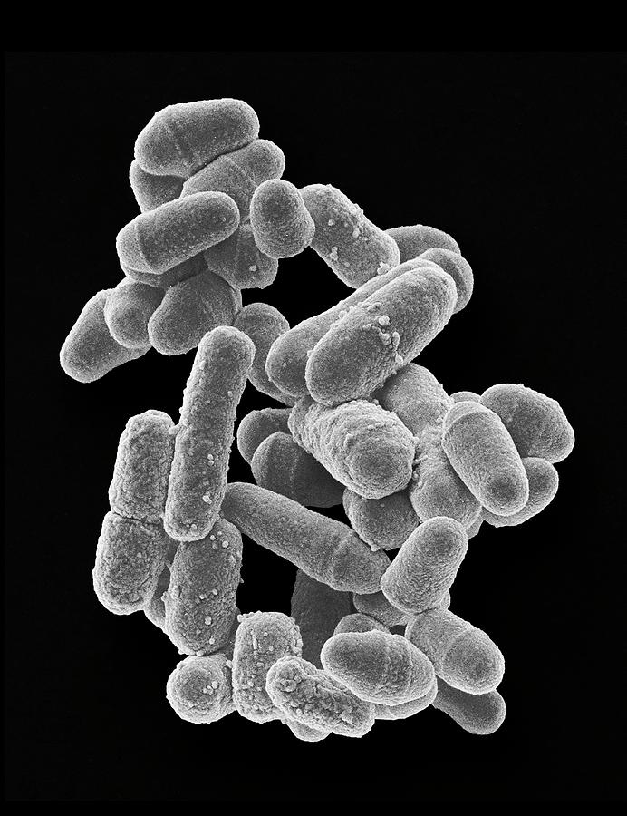 Bacteria And Yeast Photograph By Steve Gschmeissner Science Photo