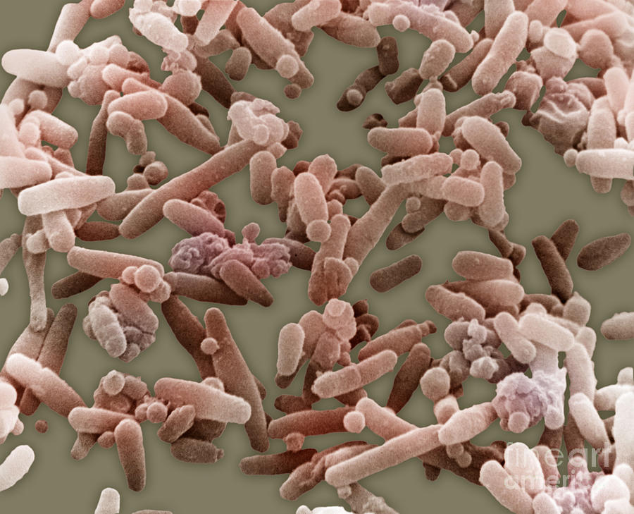 Sem Photograph - Bacteria Cultured From Alimentary Tract by David M. Phillips