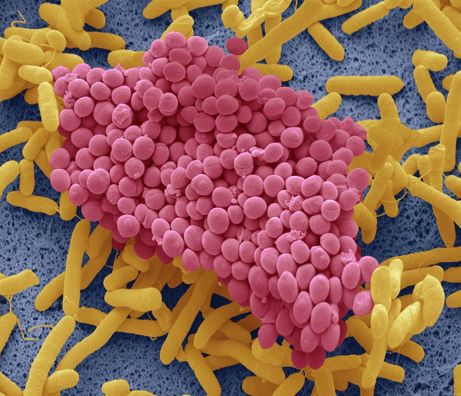 Bacteria Found On Dishcloth Photograph by Steve Gschmeissner/science Photo Library