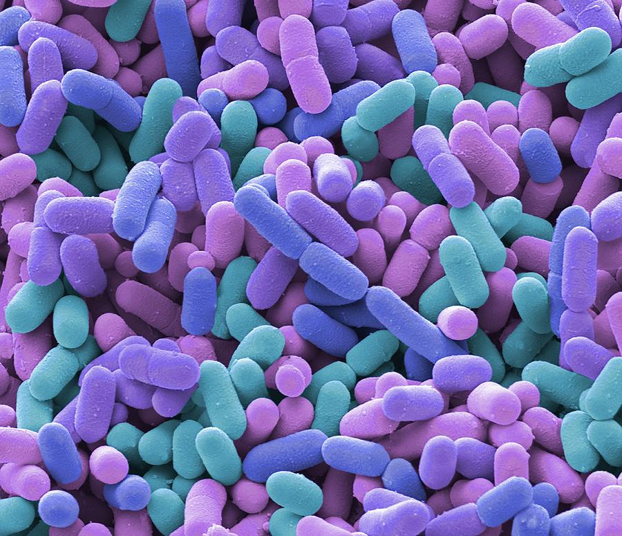 Bacteria From A Domestic Fridge Photograph by Steve Gschmeissner/science Photo Library