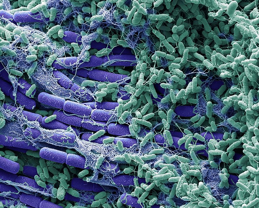 Bacteria From A House Fly Photograph by Steve Gschmeissner/science ...