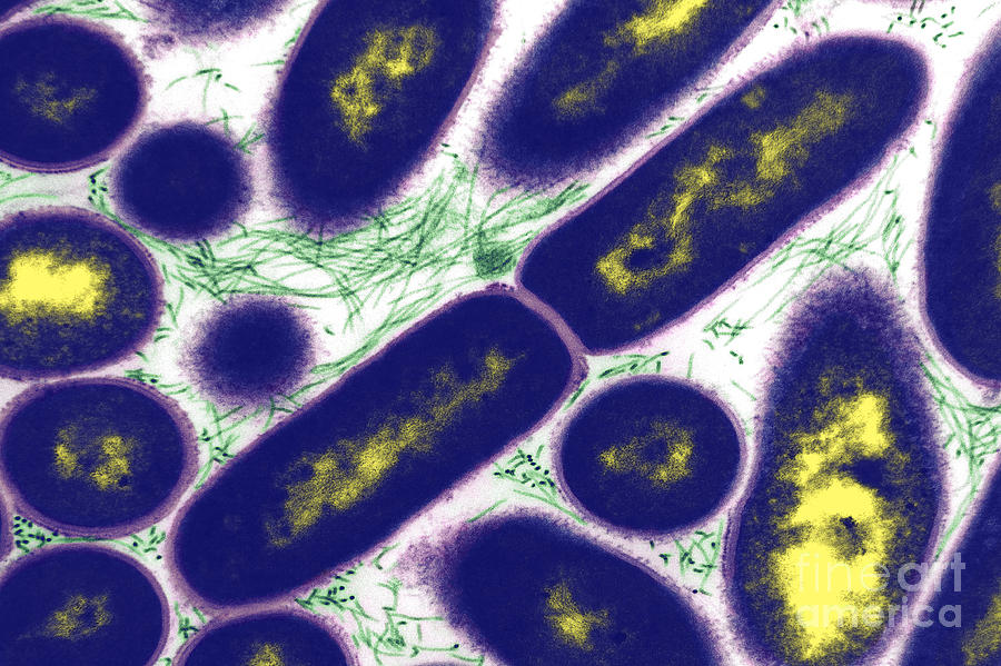 Tem Photograph - Bacteria, Haemophilus Ducrayi, Tem by David M. Phillips