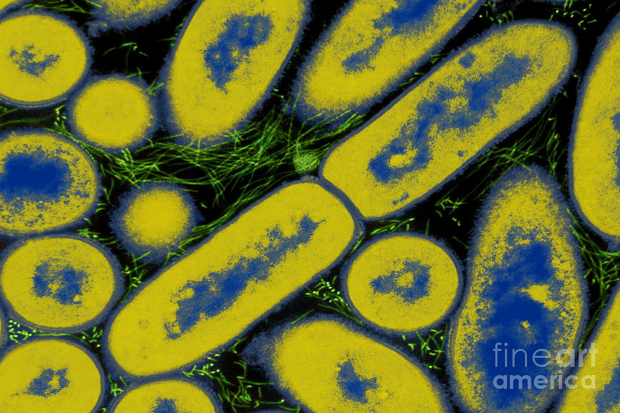 Bacteria, Haemophilus Ducreyi, Tem Photograph by David M. Phillips