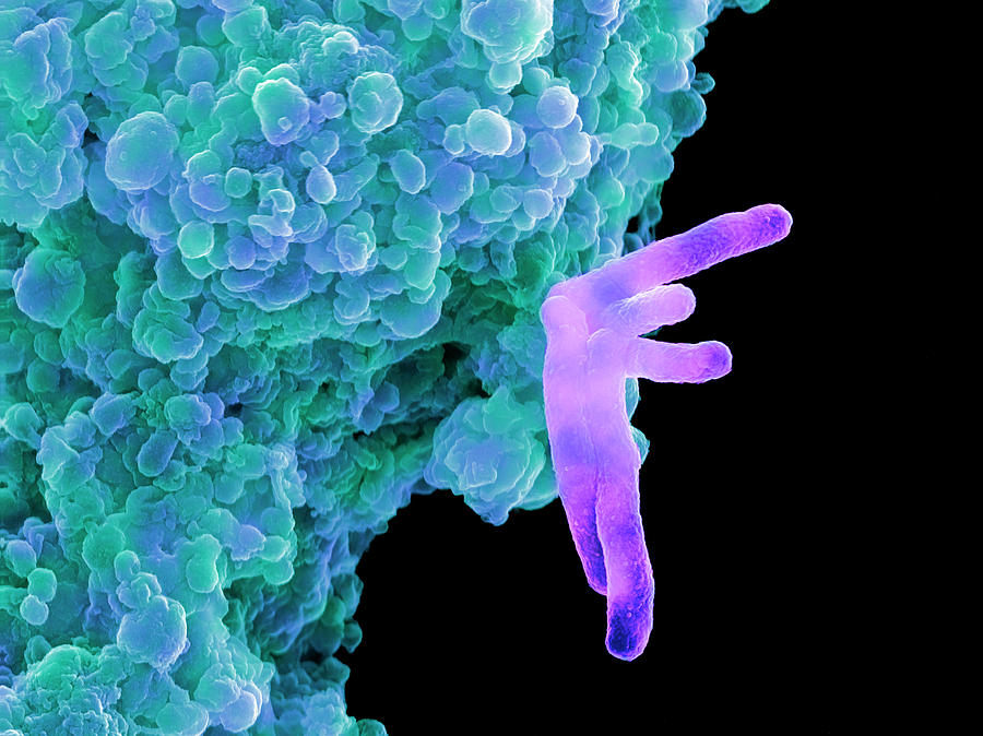 Mycobacterium Tuberculosis Photograph - Bacteria Infecting A Macrophage by 