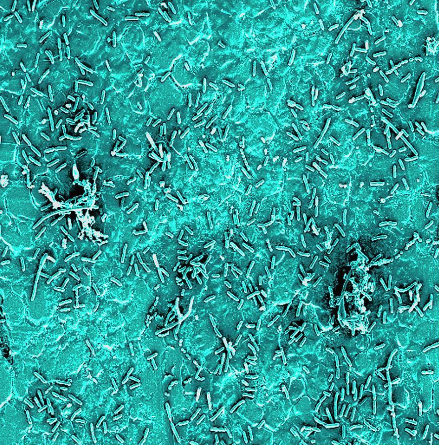 Bacteria On Stainless Steel Photograph by Sandra Silvers/us Department Of Agriculture