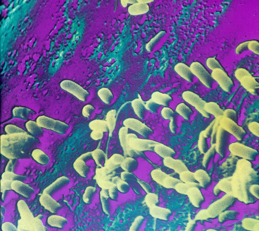 Bacteria On Tooth Enamel Sem Photograph by Chris Bjornberg