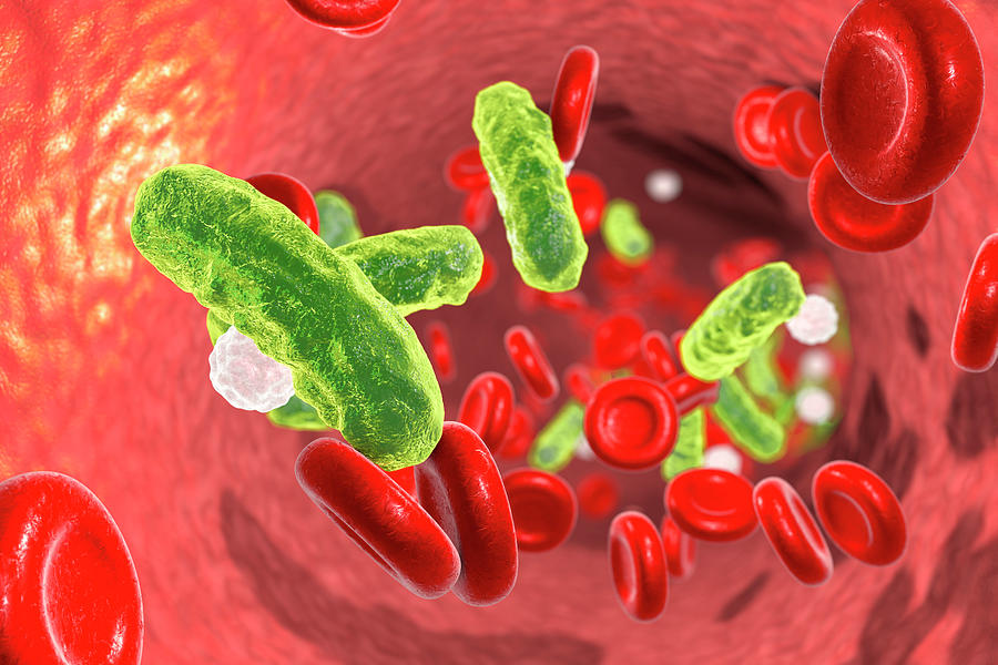 Bacterial Blood Infection Photograph by Kateryna Kon/science Photo ...