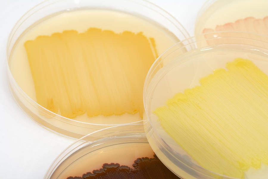 Bacterial Culture Plates Photograph by Science Stock Photography