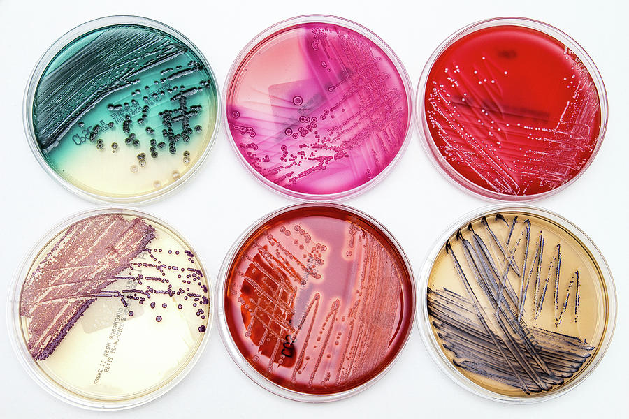Bacteria Culture - MedNotes Blog
