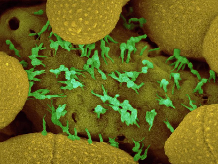 Bacteriophages Escaping From Dying Bacterium Photograph by Dennis ...